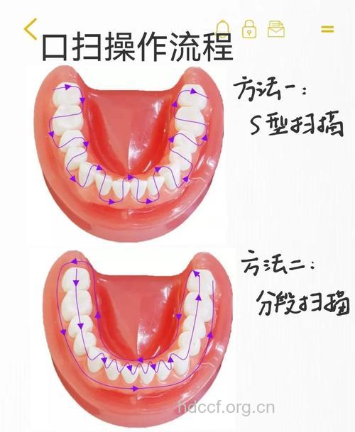 男人怎样清理口腔卫生