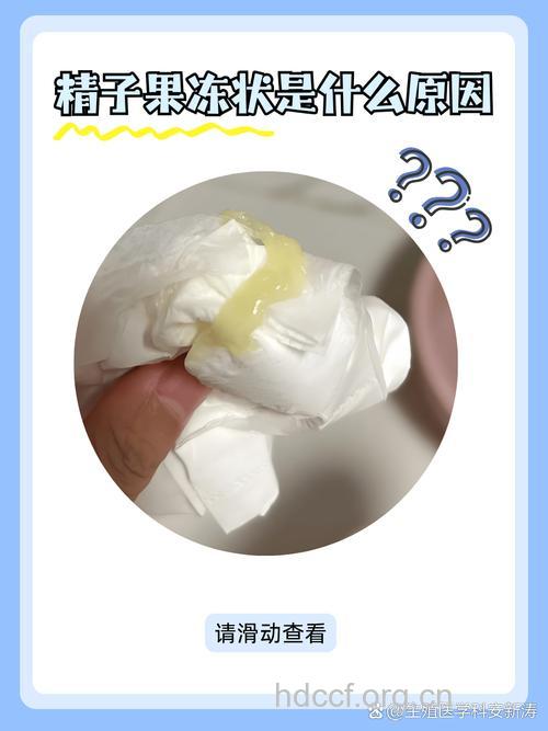 哪些精液异常情况会导致不育