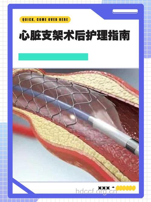 冠心病怎么进行支架手术治疗