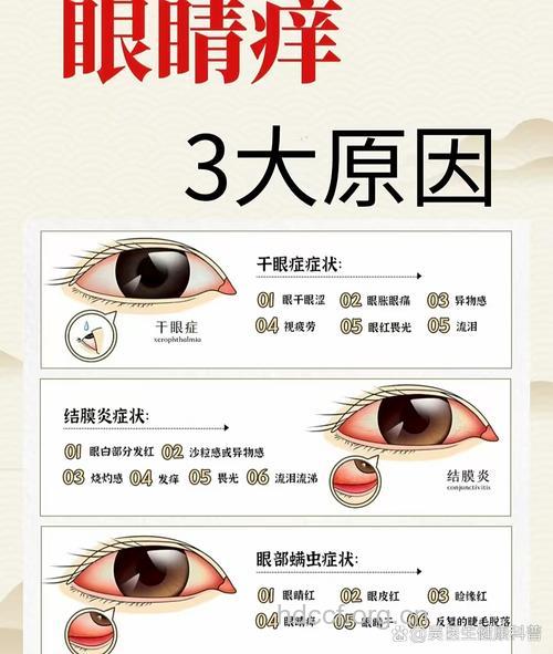 夏季男士眼睛红痒是怎么办