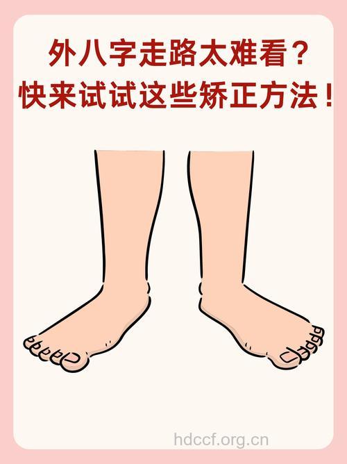 纠正男人走路外八字的九个方法