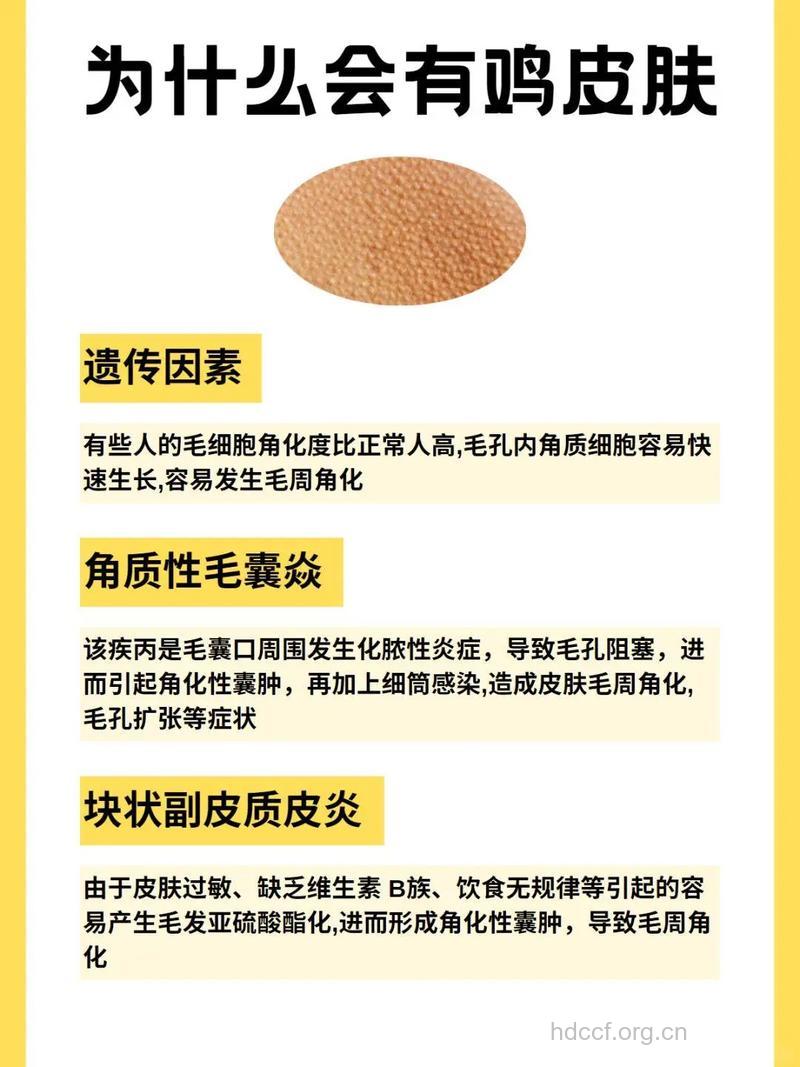 鸡皮疙瘩怎么消除 多吃黄色食物