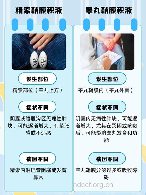 鞘膜积液与男性不育关系