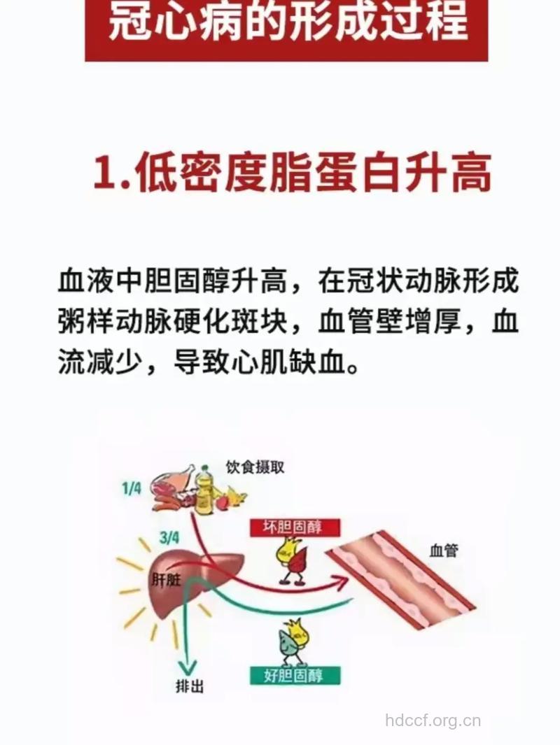 心脏是如何形成冠心病的