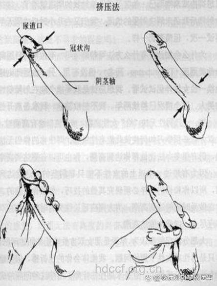 男性如何延缓早泄射精