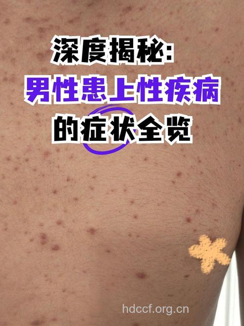 男人身体出现问题的表现症状