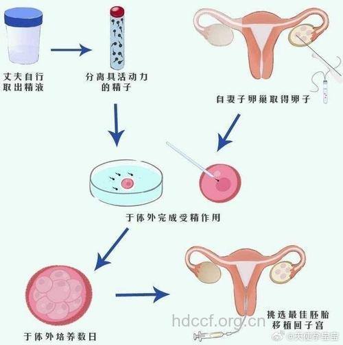 试管婴儿是怎么回事