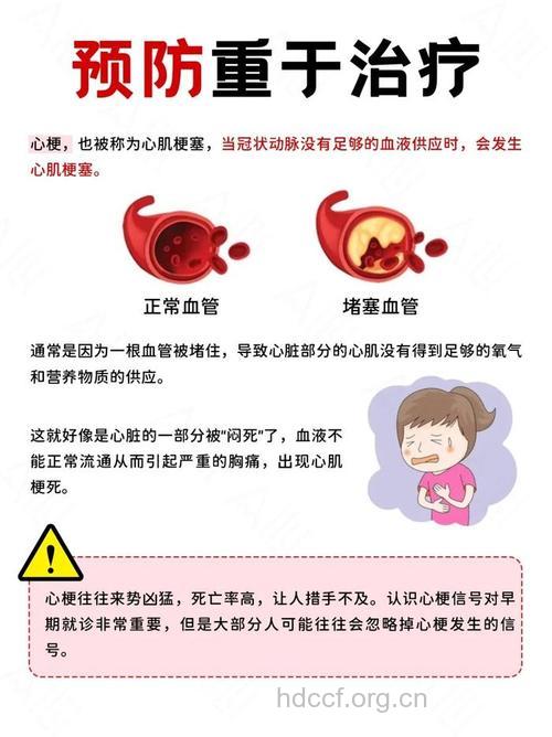 90%心梗可以预防，异常疼痛透露心梗信号