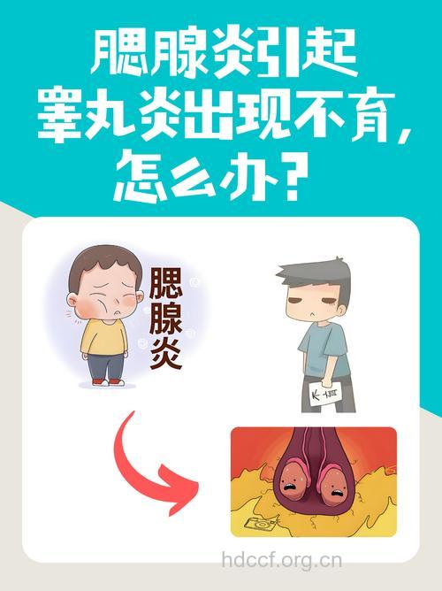 腮腺炎睾丸炎与男性不育