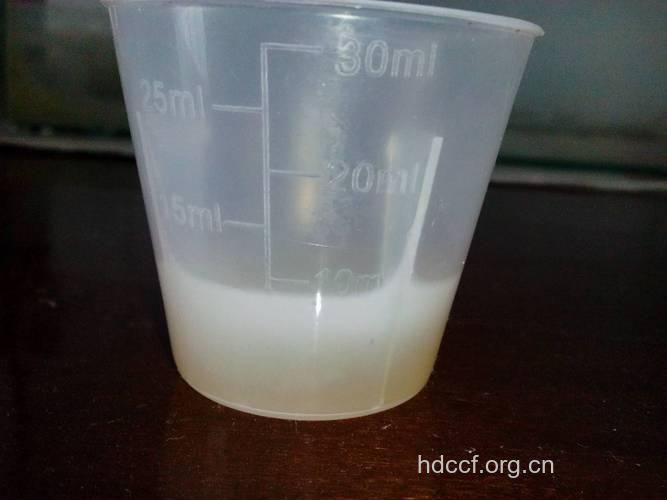 男人精液的正常标准是什么?