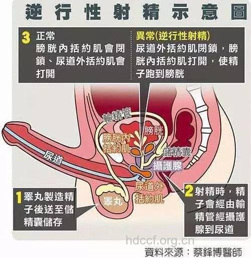 男性必知:教你看懂精液的异常