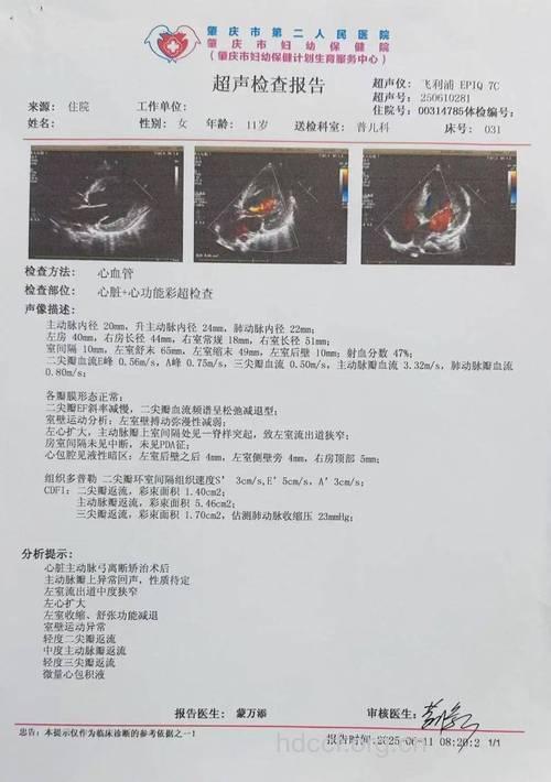 心脏检查报告单 如何读懂？