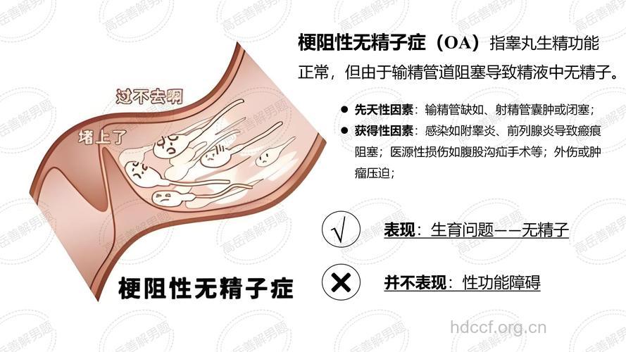 输精道梗阻的临床特征
