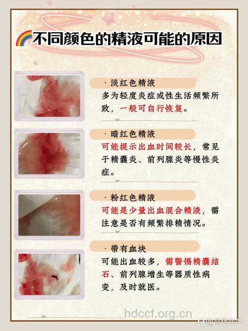 血精症不育怎么回事？