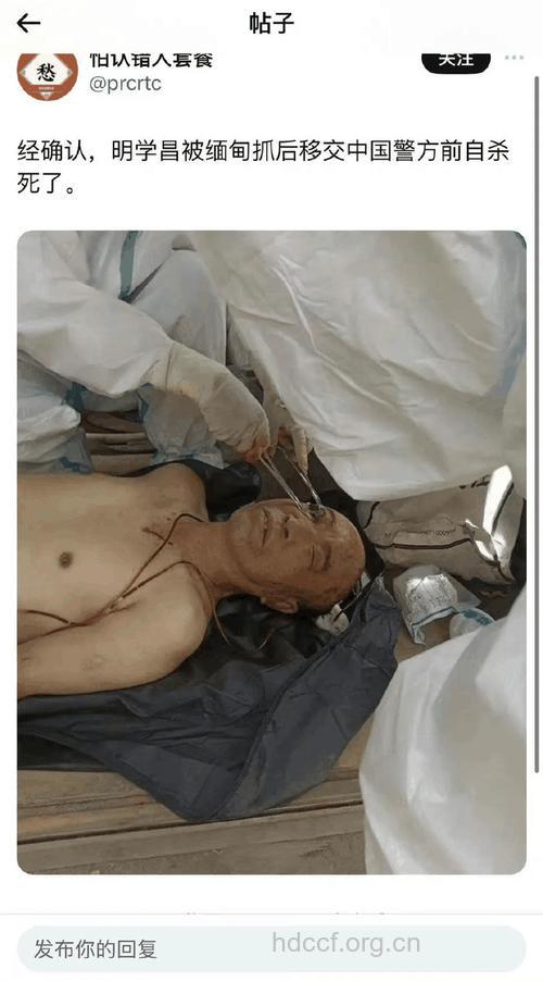 死精 男人不育的凶手