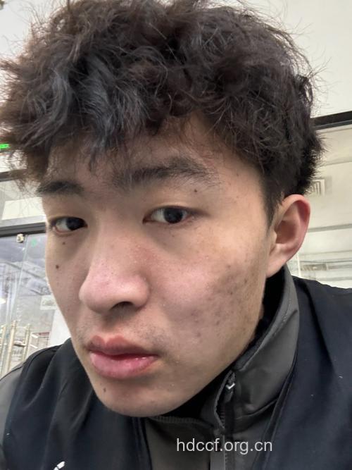 导致男人皮肤差的六大凶手