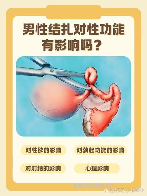 男性结扎手术会影响性功能吗？