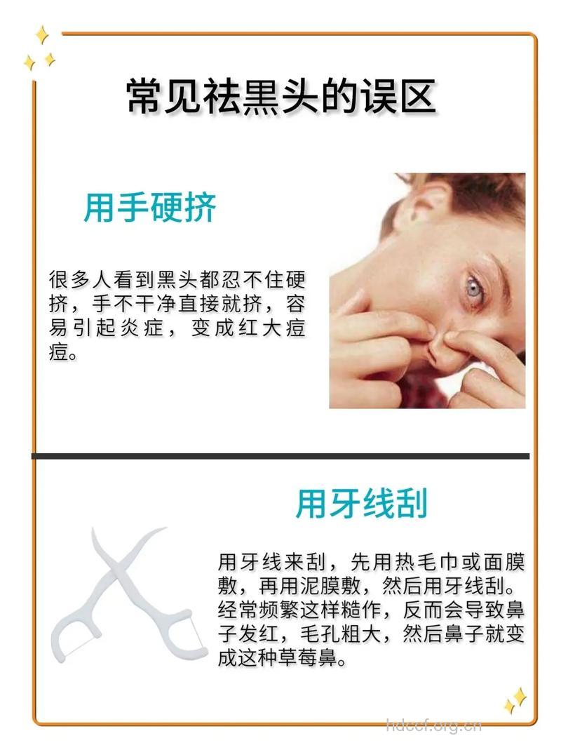 男人鼻子长黑头怎么办?