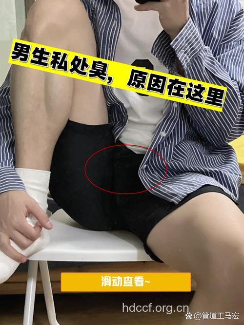 男人下体的10个难言之隐