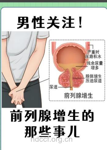 节欲也会导致前列腺增生吗