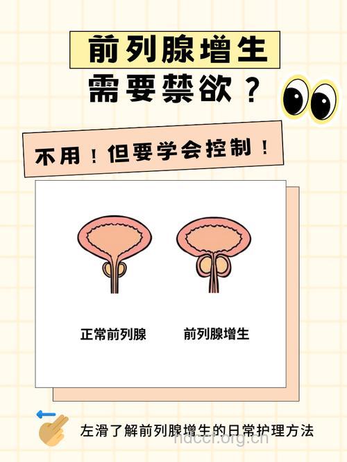 患上前列腺增生是否要禁欲
