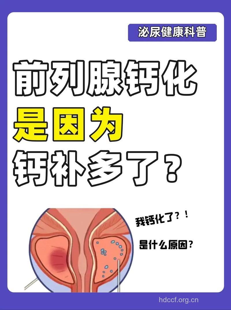 前列腺增生钙化严重吗