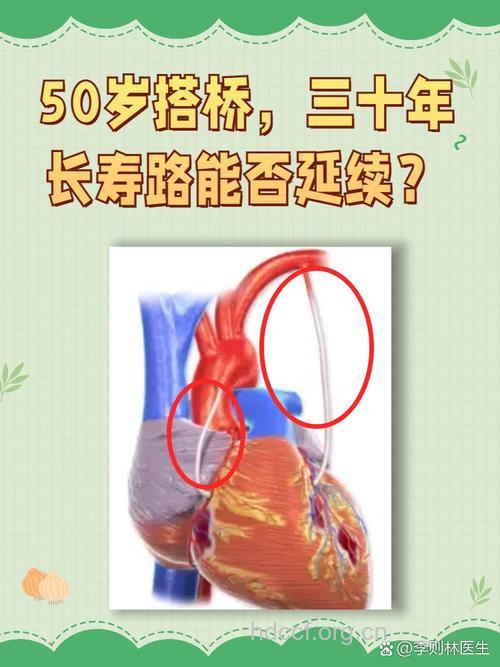 “心脏搭桥”可怕吗？