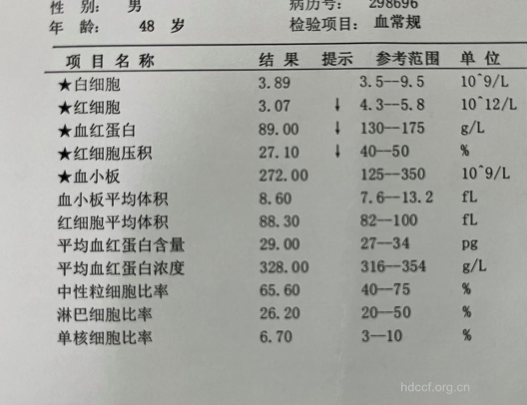 血小板增多症合并心肌梗塞1例