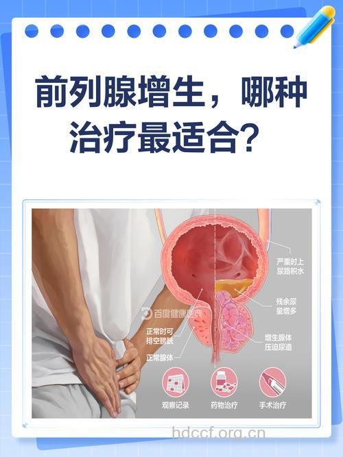 如何治疗前列腺增生效果佳呢