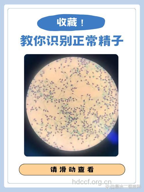 从精液看身体是否健康