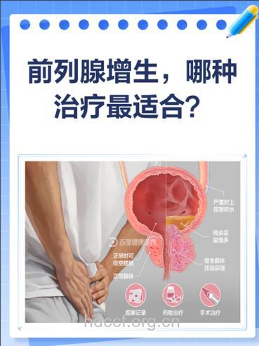 前列腺增生患者不能正确服药的原因有哪些