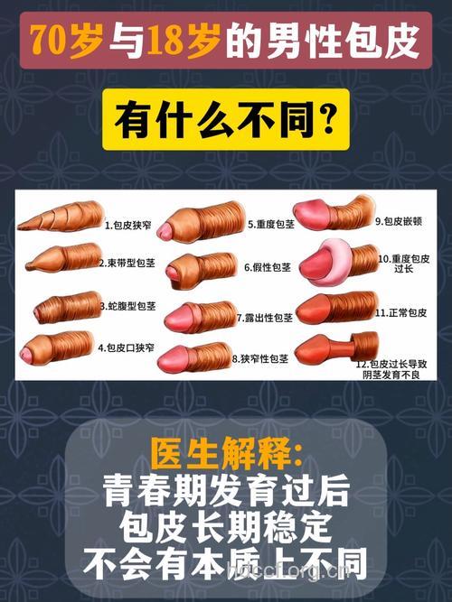 如何区别男性包皮与包茎