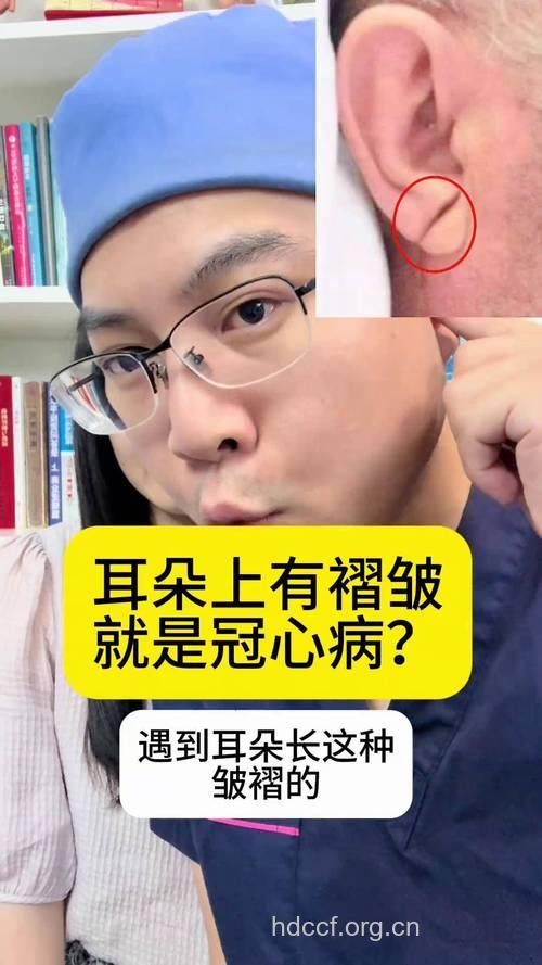 耳垂长皱纹 疑有冠心病!