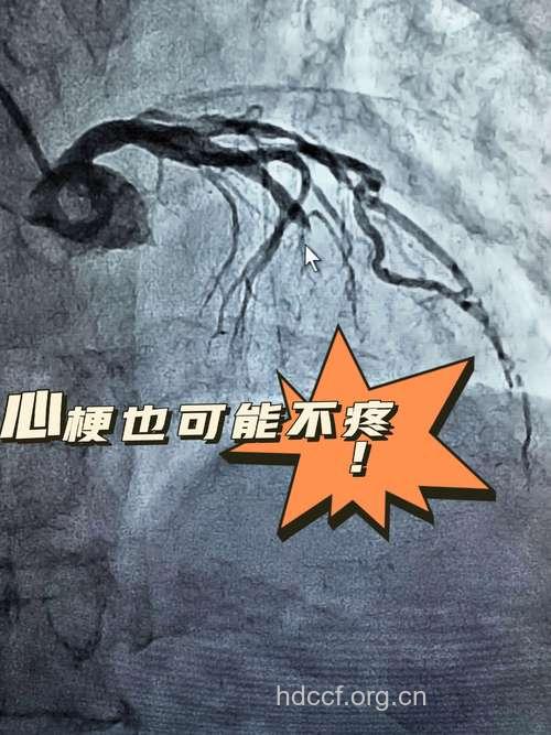 “９０后”开始被心肌梗塞“盯”上！