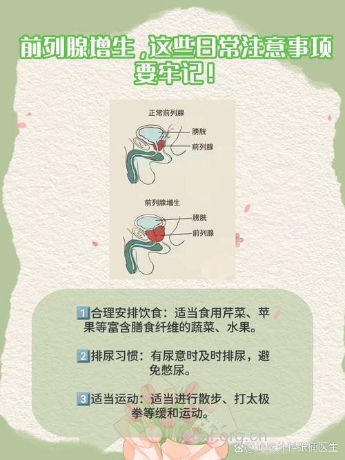 前列腺增生有哪些注意事项