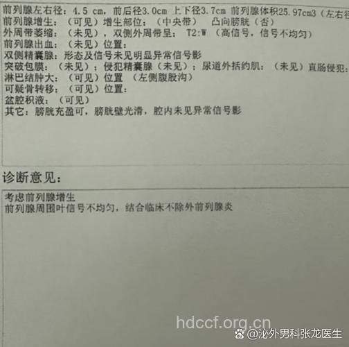 前列腺增生症的诊断依据有哪些呢