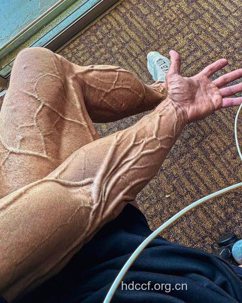 看着强壮的男人病更多