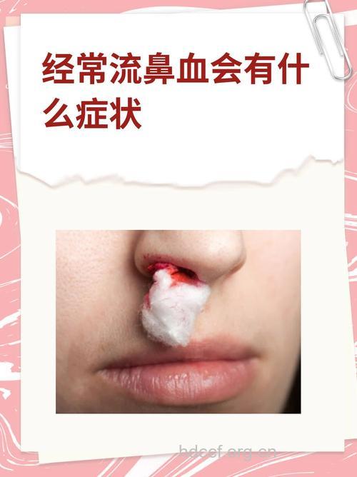 经常上网会流鼻血吗