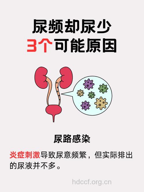 尿频怎么办 男性尿频是什么原因