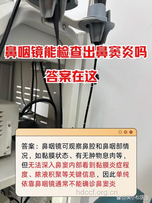 急性鼻咽炎要做哪些检查？