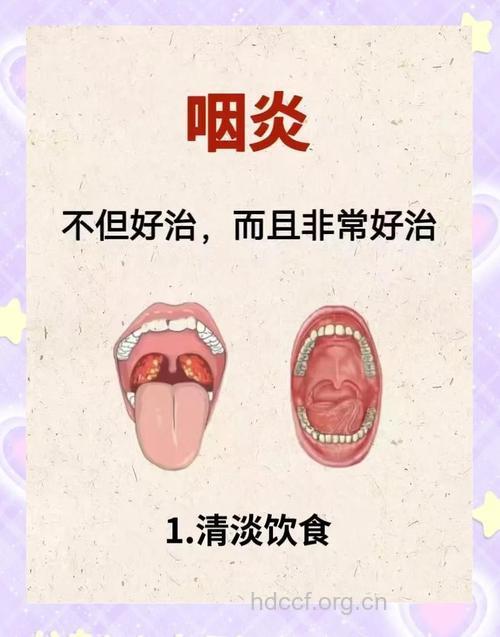 常见的咽炎的治疗方法