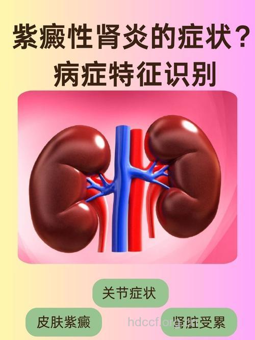 紫癜肾炎会不会导致尿毒症