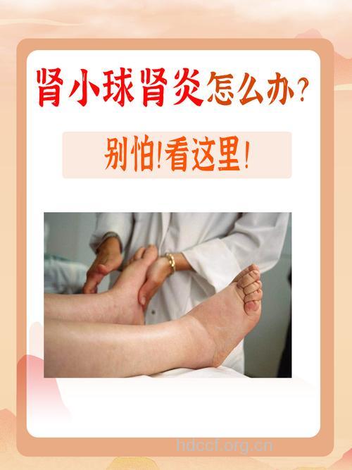 得了急性肾小球肾炎该怎么办