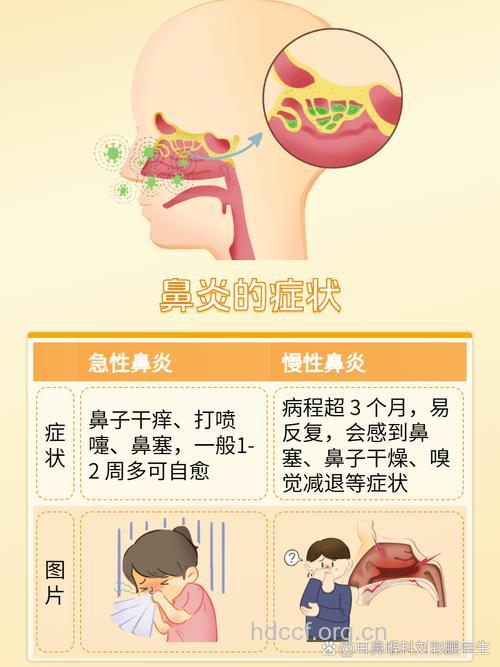患了鼻炎有什么症状