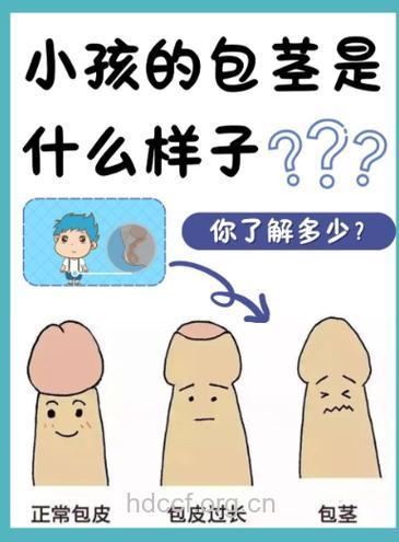 30岁男看看小弟弟衰老的标志