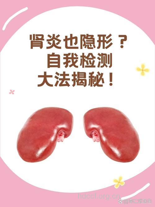 隐匿性肾炎该怎么预防