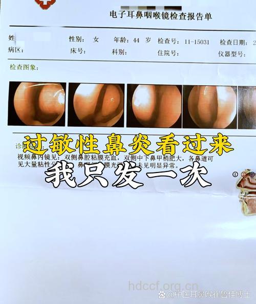 被误诊的鼻炎