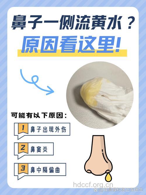鼻子流黄水的原因是什么