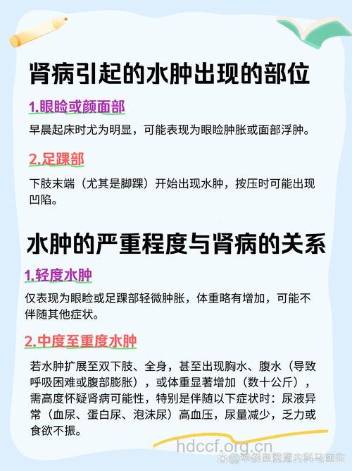 水肿是患肾炎吗