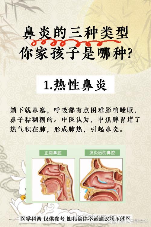 几种儿童常见的鼻炎类型